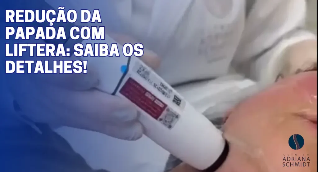 detalhes da redução da papada